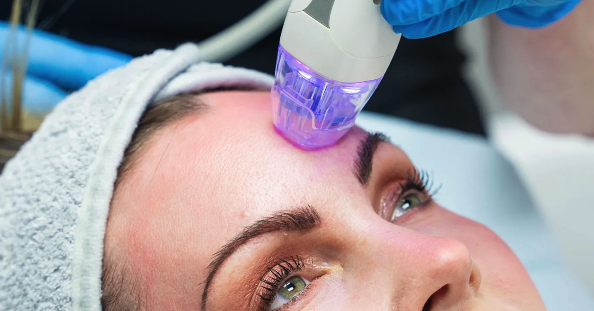 Elltight & EllAcne Treatment