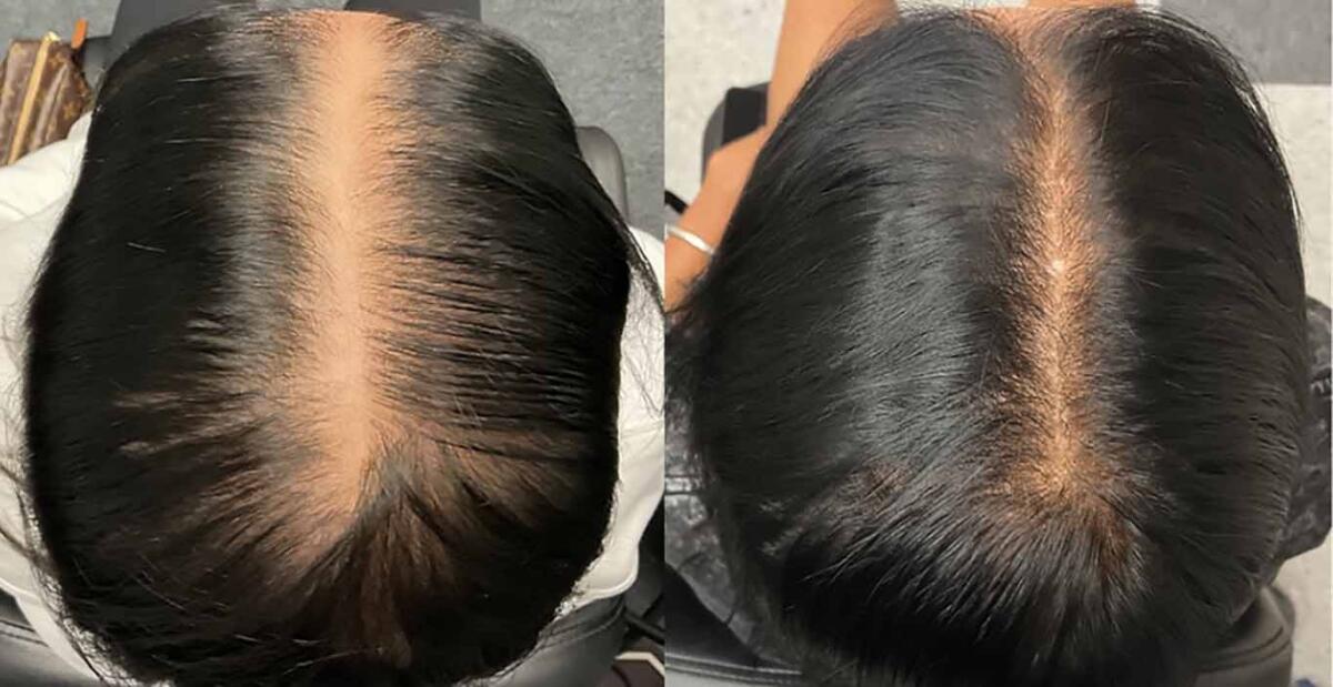 Hair Treatments